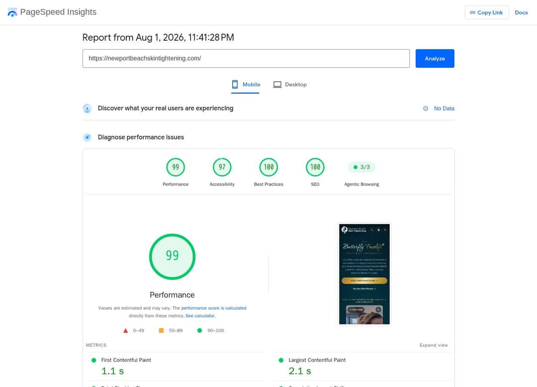 PageSpeed Insights mobile — Newport Beach Skin Tightening